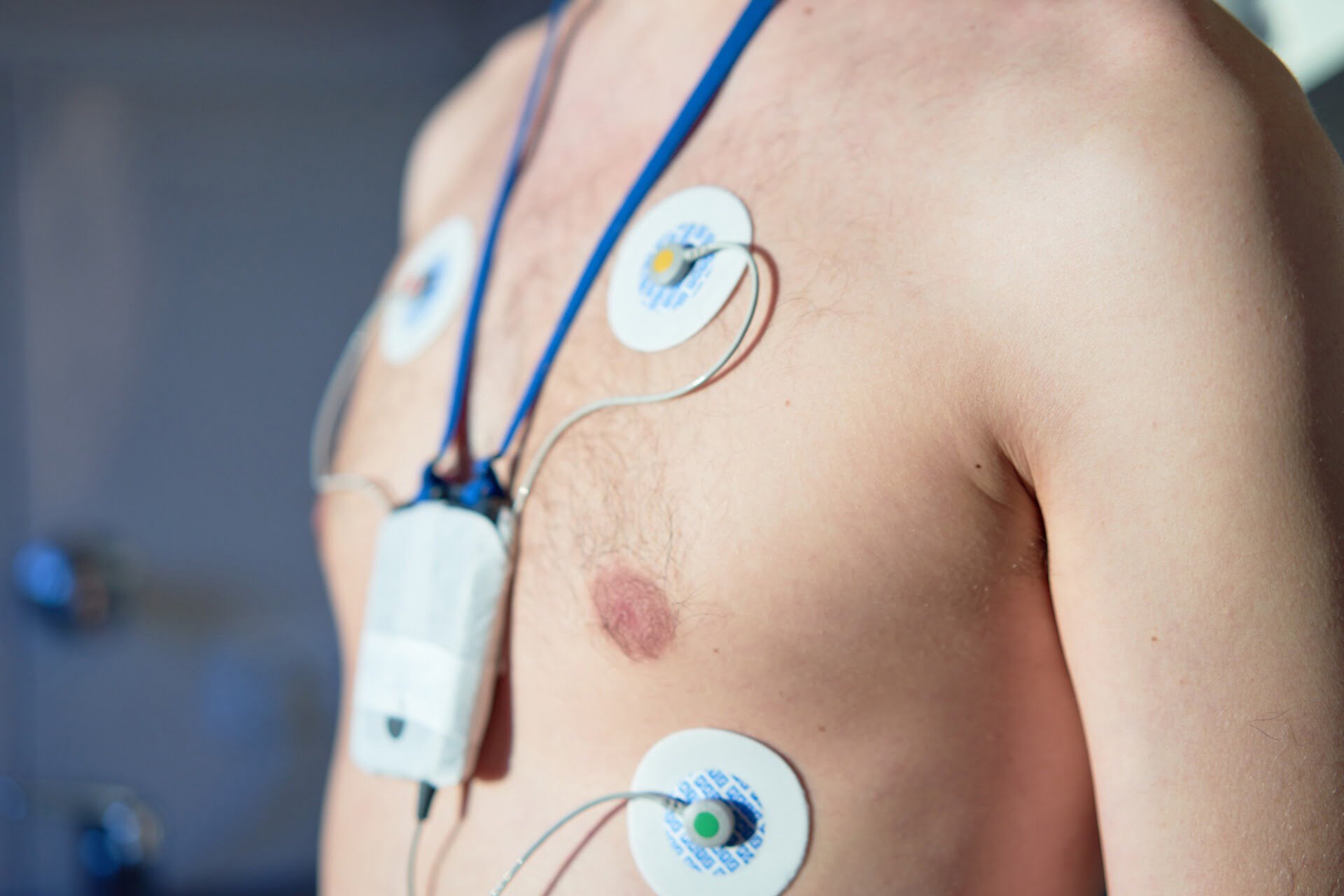 Holter EKG