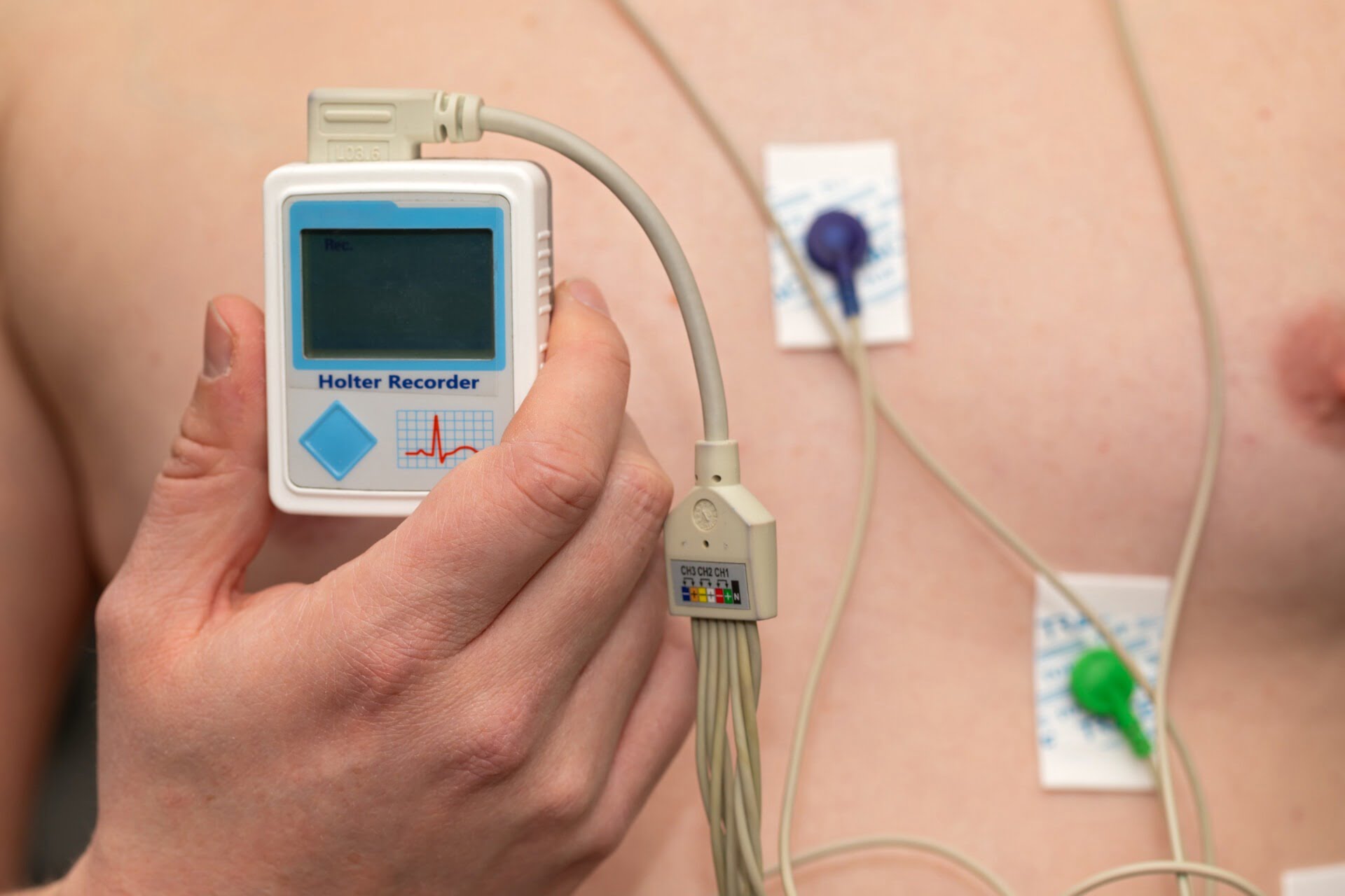 Holter EKG